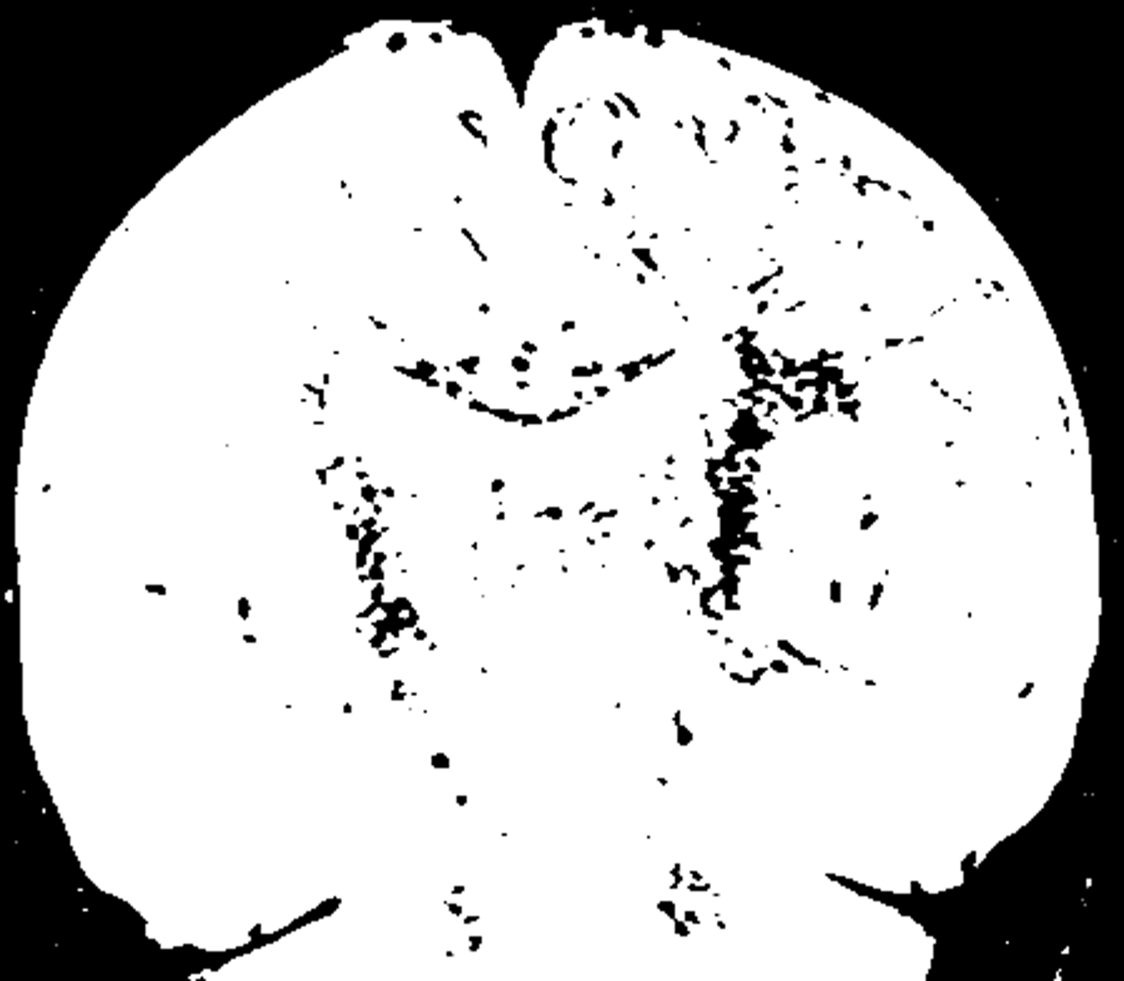 左から 乳児（1歳以下）、3歳、20歳のMRI画像